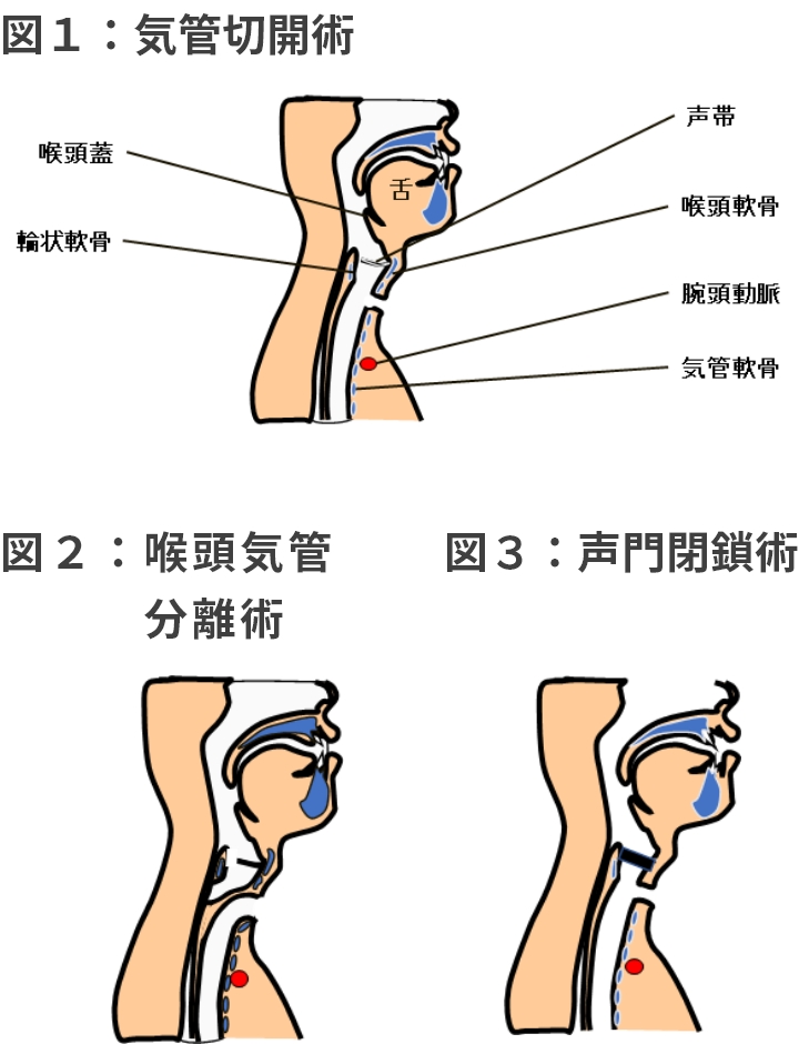 図1～3